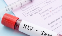 Pierścień chroniący przed HIV – wynalazek w służbie zdrowia